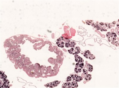 PRESERVED_SPECIMEN; ; ; microslide; ; IZ number 98975; lot count 1; Microslide 01, balsam, salivary gland, serial section; Microslide 02, balsam, salivary gland, serial section; Microsl photo