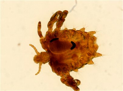 PRESERVED_SPECIMEN; ; ADULT; microslide; ; IZ number 93615; lot count 1; Microslide 01, balsam, whole mount; adult;