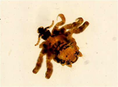 PRESERVED_SPECIMEN; ; ADULT; microslide; ; IZ number 93621; lot count 1; Microslide 01, balsam, whole mount; adult; photo