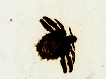 PRESERVED_SPECIMEN; ; ADULT; microslide; ; IZ number 93623; lot count 1; Microslide 01, balsam, whole mount; adult;