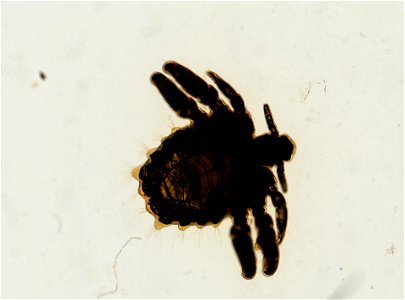 PRESERVED_SPECIMEN; ; ADULT; microslide; ; IZ number 93623; lot count 1; Microslide 01, balsam, whole mount; adult; photo