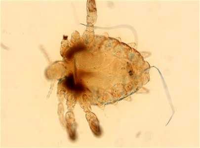 PRESERVED_SPECIMEN; ; ADULT; microslide; ; IZ number 93632; lot count 1; Microslide 01, balsam, whole mount; adult; 1943-01-01T00:00:00Z