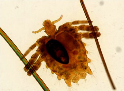 PRESERVED_SPECIMEN; ; ADULT; microslide; ; IZ number 93643; lot count 1; Microslide 01, balsam, whole mount; adult;