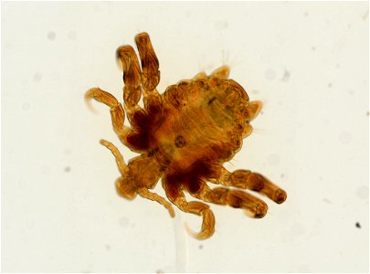 PRESERVED_SPECIMEN; ; ADULT; microslide; ; IZ number 93649; lot count 1; Microslide 01, balsam, whole mount; adult;