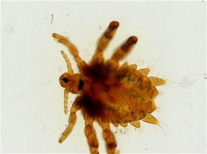PRESERVED_SPECIMEN; ; ADULT; microslide; ; IZ number 93653; lot count 1; Microslide 01, balsam, whole mount; adult;
