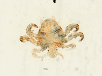 PRESERVED_SPECIMEN; ; ADULT; microslide; ; IZ number 93656; lot count 1; Microslide 01, balsam, whole mount; Microslide 01, balsam, whole mount; adult;