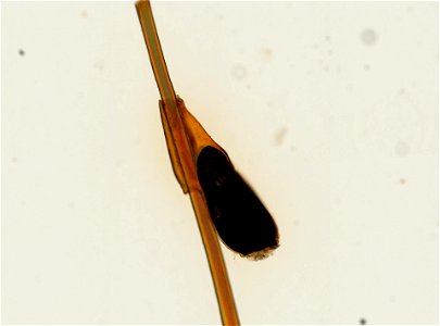 PRESERVED_SPECIMEN; ; ; microslide; ; IZ number 93665; lot count 1; Microslide 01, balsam, whole mount; egg;