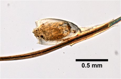 PRESERVED_SPECIMEN; ; ; microslide; ; IZ number 99329; lot count 1; Microslide 01, balsam, whole mount; nit;