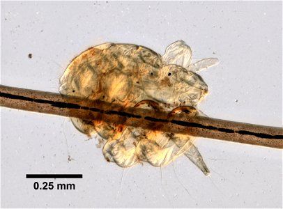 PRESERVED_SPECIMEN; ; ; microslide; ; IZ number 99356; lot count 1; Microslide 01, balsam, whole mount;