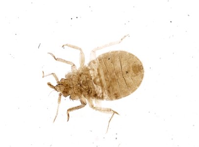 PRESERVED_SPECIMEN; ; ; microslide; ; IZ number 93676; lot count 1; Microslide 01, balsam, whole mount; other number P9.611;