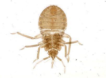 PRESERVED_SPECIMEN; ; ; microslide; ; IZ number 93684; lot count 1; Microslide 01, balsam, whole mount;