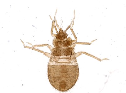 PRESERVED_SPECIMEN; ; ; microslide; ; IZ number 93686; lot count 1; Microslide 01, balsam, whole mount;