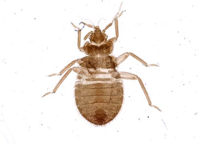 PRESERVED_SPECIMEN; ; ; microslide; ; IZ number 93687; lot count 1; Microslide 01, balsam, whole mount;