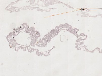 PRESERVED_SPECIMEN; ; ; microslide; ; IZ number 98917; lot count 1; Microslide 01, balsam, alimentary canal, serial section;