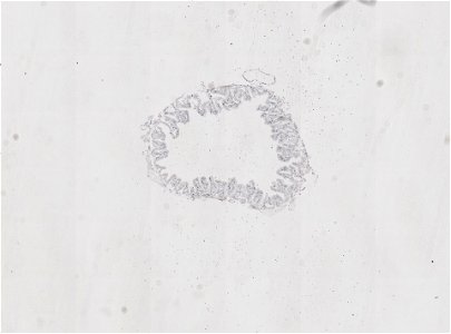 PRESERVED_SPECIMEN; ; ; microslide; ; IZ number 98920; lot count 1; Microslide 01, balsam, alimentary canal, serial section;