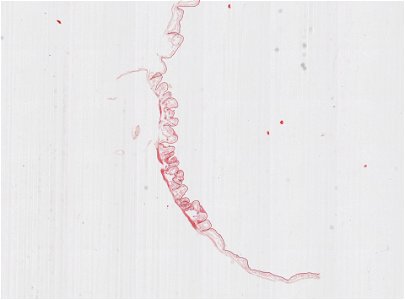 PRESERVED_SPECIMEN; ; ; microslide; ; IZ number 98921; lot count 1; Microslide 01, balsam, alimentary canal, serial section;