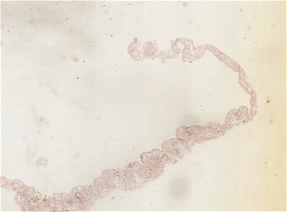 PRESERVED_SPECIMEN; ; ; microslide; ; IZ number 98924; lot count 1; Microslide 01, balsam, alimentary canal, serial section;