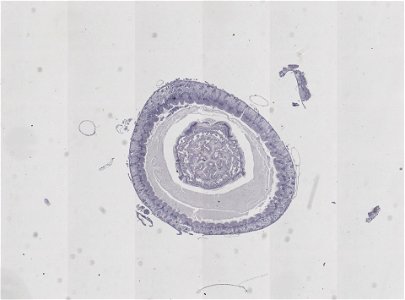 PRESERVED_SPECIMEN; ; ; microslide; ; IZ number 98927; lot count 1; Microslide 01, balsam, alimentary canal, serial section;