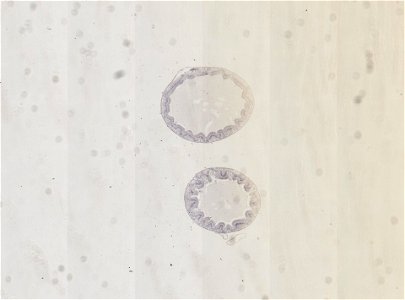 PRESERVED_SPECIMEN; ; ; microslide; ; IZ number 98928; lot count 1; Microslide 01, balsam, alimentary canal, serial section;