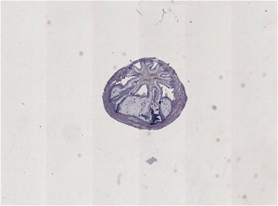 PRESERVED_SPECIMEN; ; ; microslide; ; IZ number 98929; lot count 1; Microslide 01, balsam, alimentary canal, serial section;