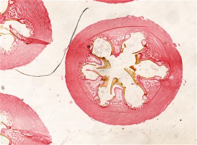 PRESERVED_SPECIMEN; ; ; microslide; ; IZ number 98937; lot count 1; Microslide 01, balsam, alimentary canal, serial section;