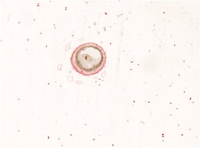 PRESERVED_SPECIMEN; ; ; microslide; ; IZ number 98940; lot count 1; Microslide 01, balsam, alimentary canal, serial section;