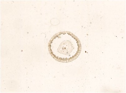 PRESERVED_SPECIMEN; ; ; microslide; ; IZ number 98941; lot count 1; Microslide 01, balsam, alimentary canal, serial section;