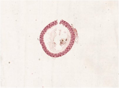 PRESERVED_SPECIMEN; ; ; microslide; ; IZ number 98944; lot count 1; Microslide 01, balsam, alimentary canal, serial section;