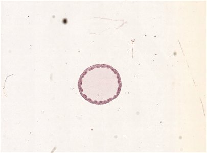 PRESERVED_SPECIMEN; ; ; microslide; ; IZ number 98946; lot count 1; Microslide 01, balsam, alimentary canal, serial section;