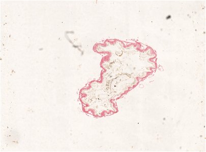 PRESERVED_SPECIMEN; ; ; microslide; ; IZ number 98947; lot count 1; Microslide 01, balsam, alimentary canal, serial section;