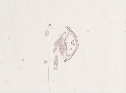 PRESERVED_SPECIMEN; FEMALE; ; microslide; ; IZ number 98949; lot count 1; Microslide 01, balsam, alimentary canal, serial section; Microslide 02, balsam, alimentary canal, serial section; Mi