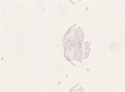 PRESERVED_SPECIMEN; FEMALE; ; microslide; ; IZ number 98949; lot count 1; Microslide 01, balsam, alimentary canal, serial section; Microslide 02, balsam, alimentary canal, serial section; Mi
