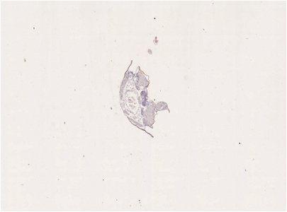 PRESERVED_SPECIMEN; FEMALE; ; microslide; ; IZ number 98949; lot count 1; Microslide 01, balsam, alimentary canal, serial section; Microslide 02, balsam, alimentary canal, serial section; Mi