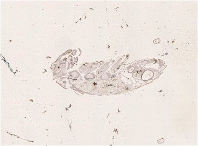 PRESERVED_SPECIMEN; FEMALE; ; microslide; ; IZ number 98952; lot count 1; Microslide 01, balsam, serial section; female;