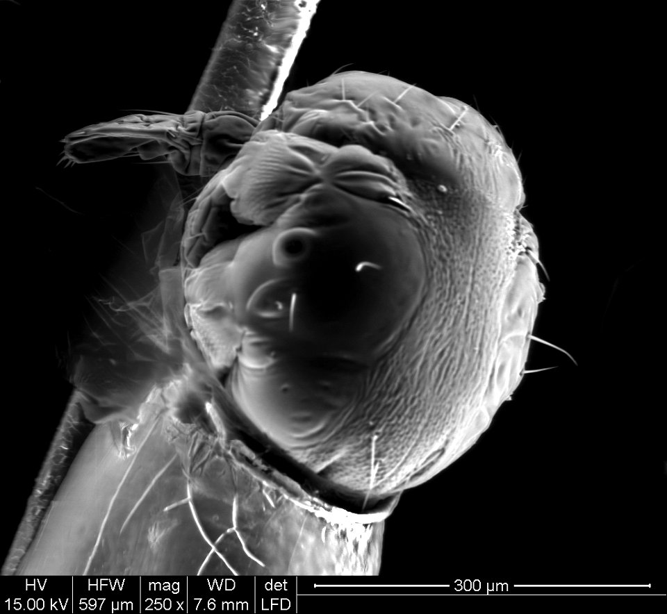 Head Louse Nit Hatching (250X Magnification)