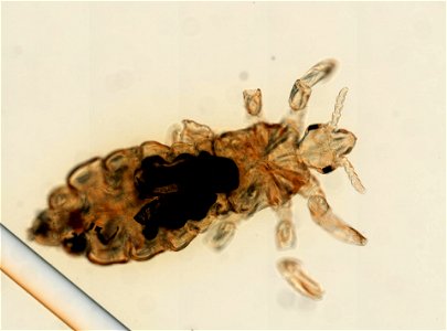 PRESERVED_SPECIMEN; ; ; microslide; ; IZ number 93558; lot count 1; Microslide 01, balsam, whole mount;