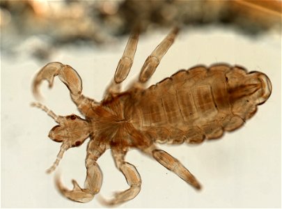 PRESERVED_SPECIMEN; MALE; ; microslide; ; IZ number 93560; lot count 1; Microslide 01, balsam, whole mount; male; other number P9.566;