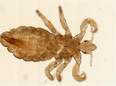 PRESERVED_SPECIMEN; MALE; ; microslide; ; IZ number 93562; lot count 1; Microslide 01, balsam, whole mount; male; other number P9.566;