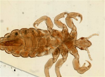 PRESERVED_SPECIMEN; MALE; ; microslide; ; IZ number 93563; lot count 1; Microslide 01, balsam, whole mount; male; other number P9.566;