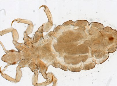 PRESERVED_SPECIMEN; FEMALE; ; microslide; ; IZ number 93564; lot count 1; Microslide 01, balsam, whole mount; female; other number P9.567;