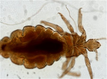 PRESERVED_SPECIMEN; FEMALE; ; microslide; ; IZ number 93566; lot count 1; Microslide 01, balsam, whole mount; female; other number P9.567;