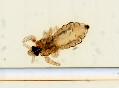 PRESERVED_SPECIMEN; ; ; microslide; ; IZ number 93570; lot count 1; Microslide 01, balsam, whole mount; photo