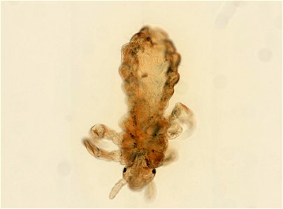 PRESERVED_SPECIMEN; ; ; microslide; ; IZ number 93585; lot count 1; Microslide 01, balsam, whole mount; photo