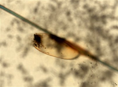 PRESERVED_SPECIMEN; ; ; microslide; ; IZ number 93591; lot count 1; Microslide 01, balsam, whole mount; egg;