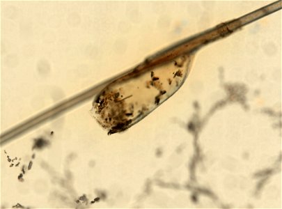 PRESERVED_SPECIMEN; ; ; microslide; ; IZ number 93593; lot count 1; Microslide 01, balsam, whole mount; egg;