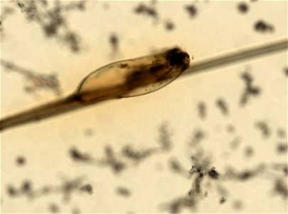 PRESERVED_SPECIMEN; ; ; microslide; ; IZ number 93596; lot count 1; Microslide 01, balsam, whole mount; egg;