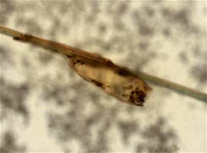 PRESERVED_SPECIMEN; ; ; microslide; ; IZ number 93598; lot count 1; Microslide 01, balsam, whole mount; egg;