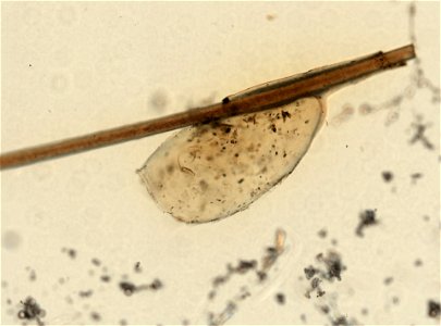 PRESERVED_SPECIMEN; ; ; microslide; ; IZ number 93599; lot count 1; Microslide 01, balsam, whole mount; egg;