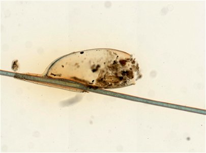 PRESERVED_SPECIMEN; ; ; microslide; ; IZ number 93601; lot count 1; Microslide 01, balsam, whole mount; egg;