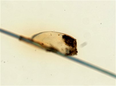 PRESERVED_SPECIMEN; ; ; microslide; ; IZ number 93604; lot count 1; Microslide 01, balsam, whole mount; egg;